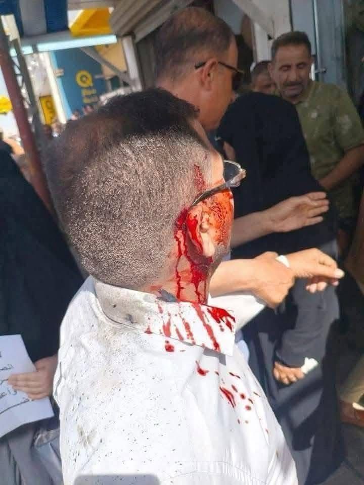 بالصور.. الدماء تسيل من الملاكات التدريسية بعد الاعتداء عليهم من قوات الشغب في ذي قار