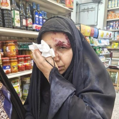 بالصور.. الدماء تسيل من الملاكات التدريسية بعد الاعتداء عليهم من قوات الشغب في ذي قار